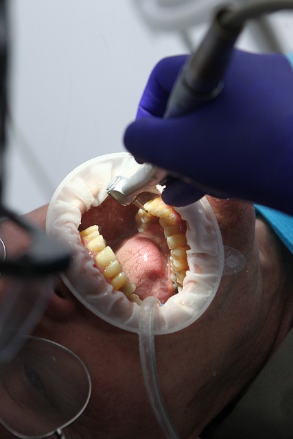 dentist-640x480-85258542.jpeg