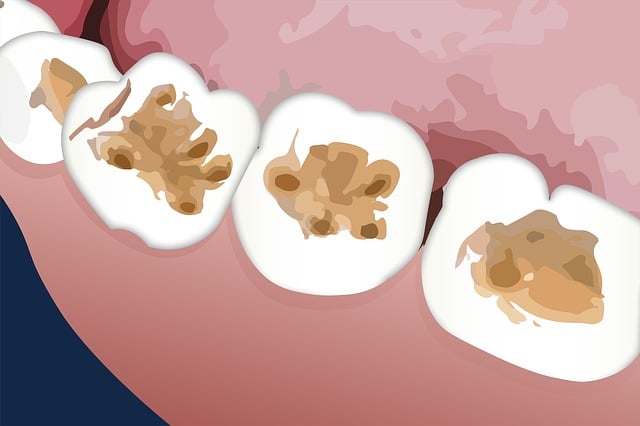 dentist-640x480-2325223.jpeg