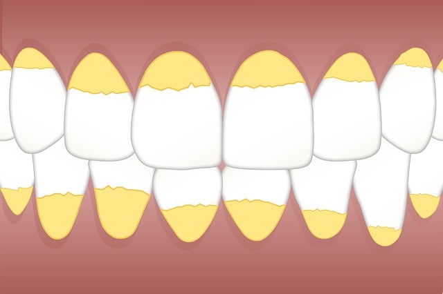 dentist-640x480-37164724.jpeg